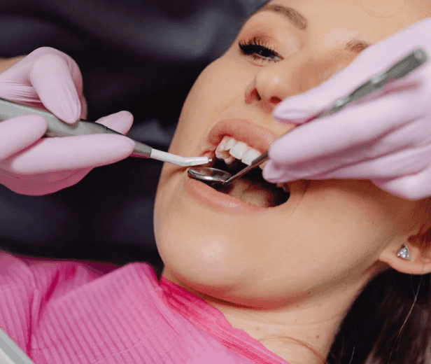 Teeth Whitening