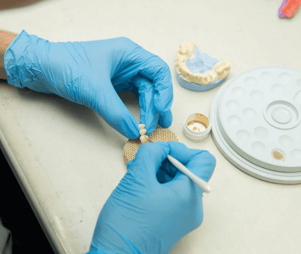 Dental Implants